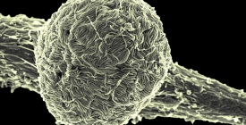 Congo: m�s de 670 casos sospechosos y 160 muertes sospechosas por brote de �bola