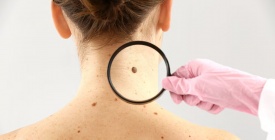 Chequeos gratuitos de lunares y acciones de prevenci�n del c�ncer de piel en la Expo Prado
