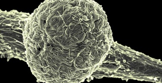 Congo: m�s de 670 casos sospechosos y 160 muertes sospechosas por brote de �bola