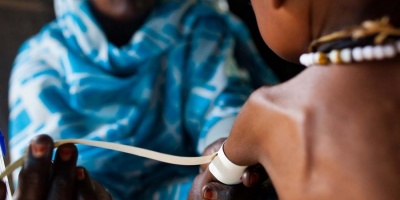 La OMS publica una nueva directriz para abordar la desnutricin aguda en nios menores de cinco aos