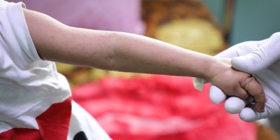 La OMS alerta sobre un aumento de casos de sarampi�n en Europa: m�s de 30 veces en comparaci�n con 2022