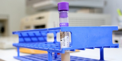 Uruguay alcanz� los 158 casos de dengue