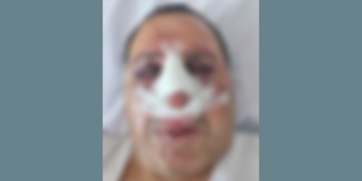 Antes de atacar el comit� del FA, delincuentes golpearon brutalmente a un "pesado" narcotraficante