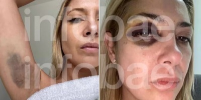 Se conocieron fotos que probar�a la denuncia de Y��ez sobre Alberto Fern�ndez