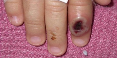 En Argentina, aislaron a un buque en el R�o Paran� por un posible caso de viruela del mono en la tripulaci�n