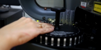 La OMS aprueba primera testeo de diagn�stico de Mpox para uso de emergencia