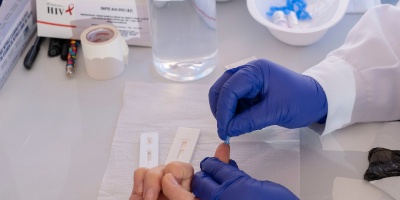 Seis pacientes fueron infectados con VIH tras recibir un trasplante de �rganos en Brasil