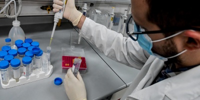 En 2024, se registraron picos del SARS-CoV-2 en aguas residuales en Uruguay, seg�n estudio del Instituto de Higiene