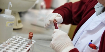 En Uruguay  hay ms de 280 personas con hemofilia
