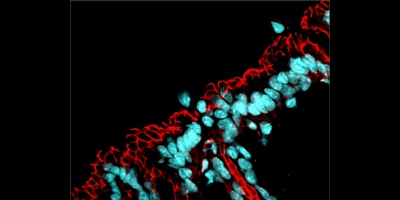 Descubren un mecanismo celular que altera la microbiota intestinal y aumenta la aparicin de enfermedades mltiples