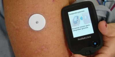 Desarrollan un sistema de implantes para tratar la diabetes tipo 1 oxigenando las clulas productoras de insulina