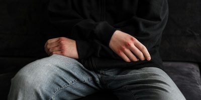 Autolesiones en adolescentes 
