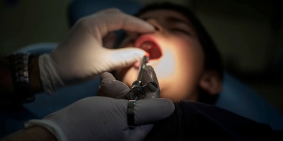 En ASSE se han realizado 16700 intervenciones odontolgicas en lo que va del ao y hay lista de espera 