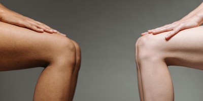 Cuidando nuestras rodillas