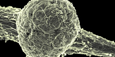 Congo: m�s de 670 casos sospechosos y 160 muertes sospechosas por brote de �bola