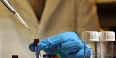 MSP lanz� plan de prevenci�n del �bola y dijo no tener informaci�n acerca de uruguayo contagiado