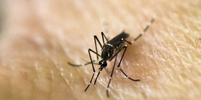  Detectan en Espaa el primer caso de feto con microcefalia asociado al zika