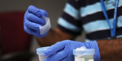 Anuncian casos de zika y dengue importados