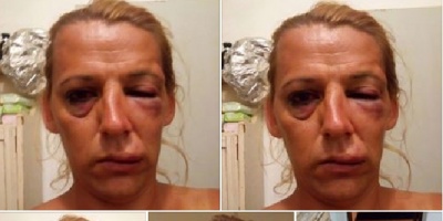 Agreden brutalmente a trans en R�o Negro 