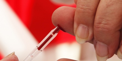 Realizar�n test gratuitos de VIH en playa Ram�rez