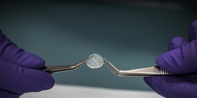 Director de banco de esperma holand�s podr�a haber engendrado 60 hijos propios