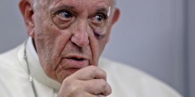 El papa brome sobre su golpe: "Tengo el ojo como compota"
