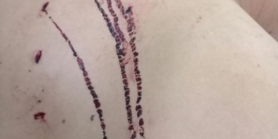 UNATRA denuncia despido abusivo de un trabajador apu�alado por un compa�ero