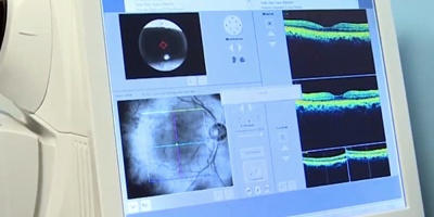 Hospital de Ojos realiz� m�s de 75.000 intervenciones