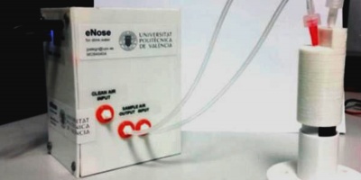 Desarrollan un detector de olores capaz de distinguir enfermedades del colon