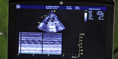 Embarazos de adolescentes bajaron a 12,7% en 2017