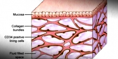 Descubren que el "l�quido intersticial" del cuerpo humano, explicar�a la propagaci�n del c�ncer, o las arrugas