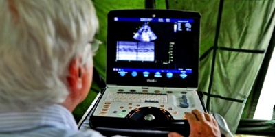 Desarrollan nuevo mtodo de ultrasonidos para diagnosticar cncer de prstata