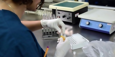 Linfedema, una secuela de cncer que no tiene cura pero puede tratarse