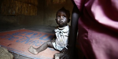 El hambre subi en frica subsahariana a 237 millones de personas en 2017