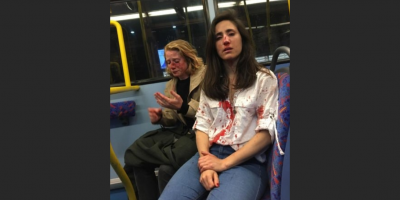 Primera Ministra britnica conden brutal ataque homfobo contra uruguaya y su pareja en Londres