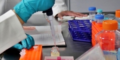 Cient�ficos hallan m�todo para neutralizar al glioblastoma, un letal tumor cerebral