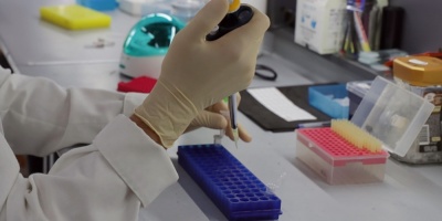 Una contrarreloj por la vacuna contra el nuevo coronavirus...y por la patente
