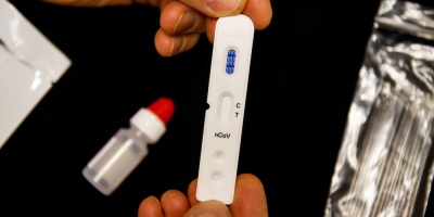 Coronavirus: MSP cambi la forma de registrar los casos positivos