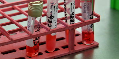 Instituciones mdicas plantean preocupacin por baja cifra de test diagnsticos