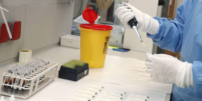 Ascienden a 535 los casos de coronavirus COVID-19 en el pas