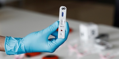 Oxford comenzar a probar una vacuna para el COVID-19 en humanos esta semana