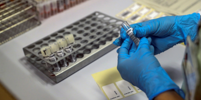 La COVID-19 no ha mutado en diferentes tipos de virus, segn un nuevo estudio