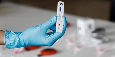 Israel anunci un "avance significativo" en la bsqueda de un antdoto contra el coronavirus