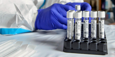 Argentina gestiona exportar a varios pases su "simple" test rpido de COVID