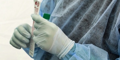 Miles de personas buscan un test en Brasilia antes de reapertura comercial