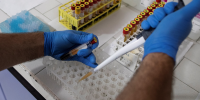 COVID-19: Un total de 14 nuevos casos fueron confirmados