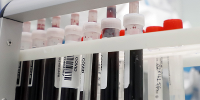 COVID-19: Hay 4 casos nuevos y 100 personas cursando la enfermedad