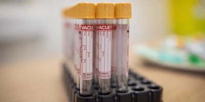 Confirman dos casos de coronavirus en San Antonio, Canelones