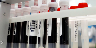 Covid 19 en Nueva Palmira provoca cierre de centro de Salud