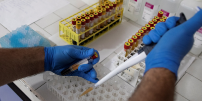 Tres casos nuevos de coronavirus en Colonia
